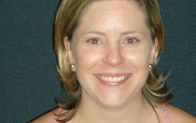 5 Years with the MD Team