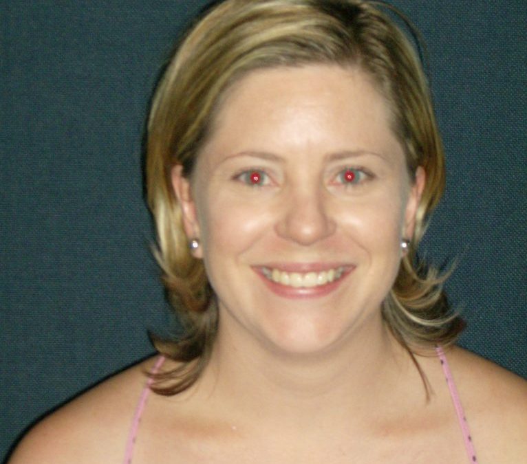 5 Years with the MD Team